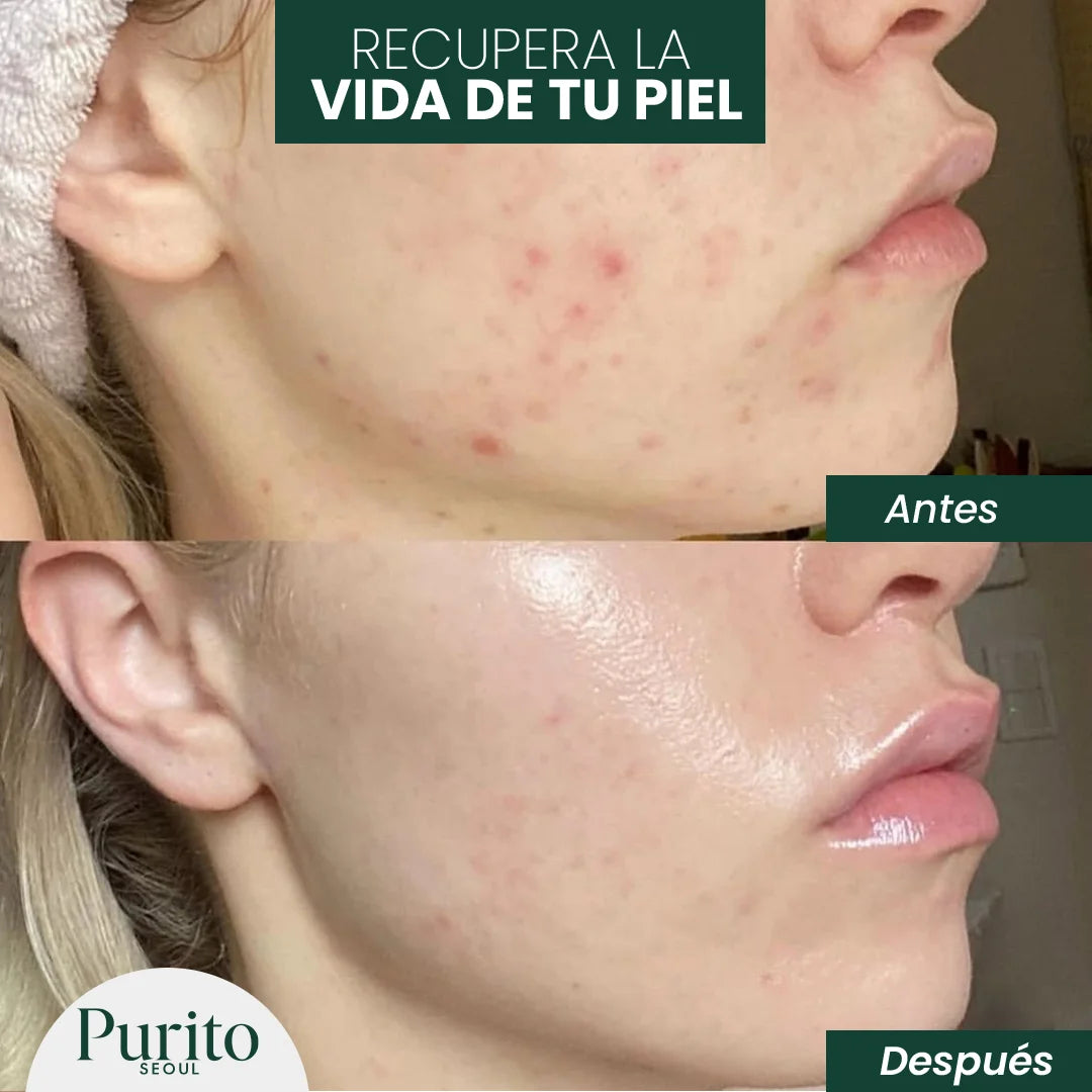 Purito Crema Reparadora de Cutis | Dermatológicamente comprobada🌿