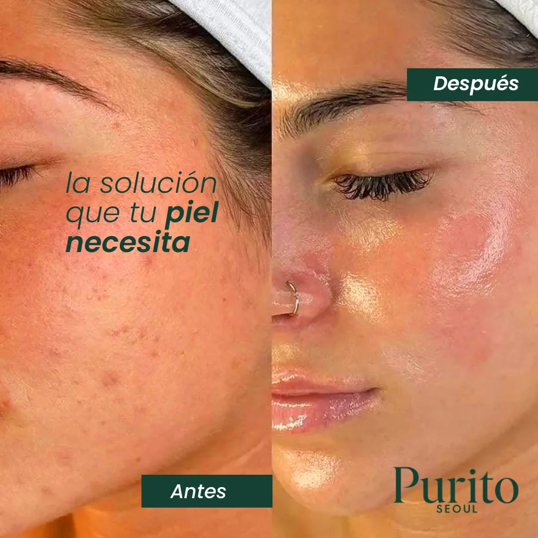 Purito Crema Reparadora de Cutis | Dermatológicamente comprobada🌿