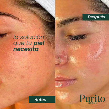 Purito Crema Reparadora de Cutis | Dermatológicamente comprobada🌿